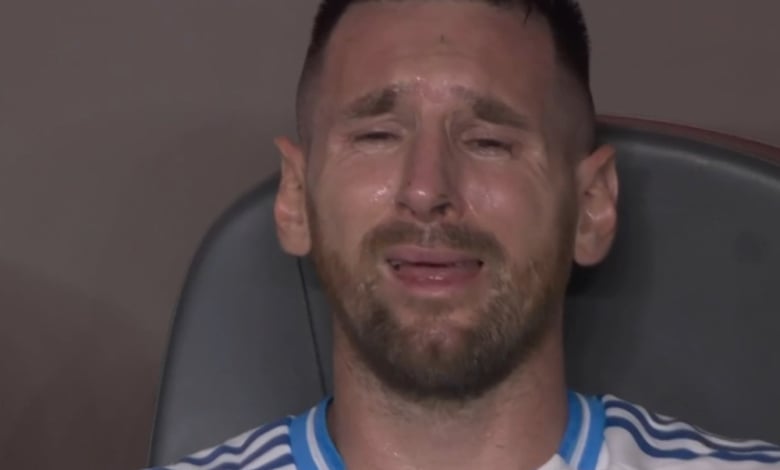 Ужасно! Ето как изглежда кракът на Меси след контузията ВИДЕО/СНИМКИ